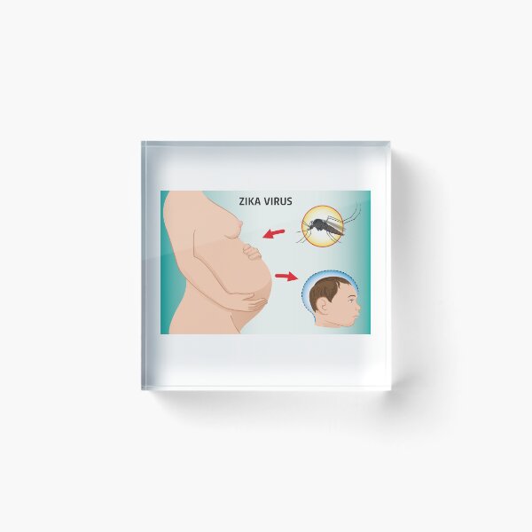 Item preview, Illustration of a pregnant with Zika Virus and newborn baby with microcephaly disease, Aedes. Ideal for informational and institutional related sanitation and medicine designed and sold by LucianoCosmo.