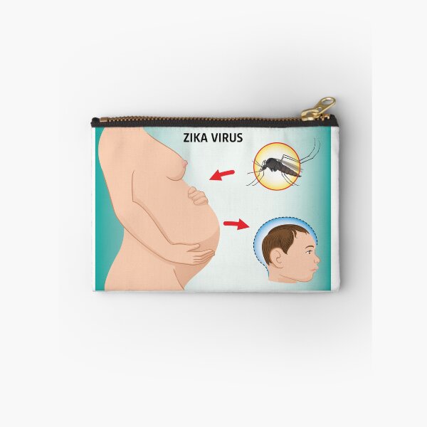 Item preview, Illustration of a pregnant with Zika Virus and newborn baby with microcephaly disease, Aedes. Ideal for informational and institutional related sanitation and medicine designed and sold by LucianoCosmo.