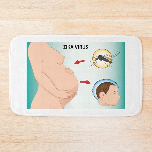 Item preview, Illustration of a pregnant with Zika Virus and newborn baby with microcephaly disease, Aedes. Ideal for informational and institutional related sanitation and medicine designed and sold by LucianoCosmo.