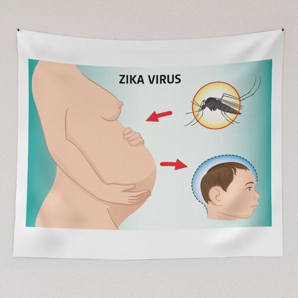 Item preview, Illustration of a pregnant with Zika Virus and newborn baby with microcephaly disease, Aedes. Ideal for informational and institutional related sanitation and medicine designed and sold by LucianoCosmo.