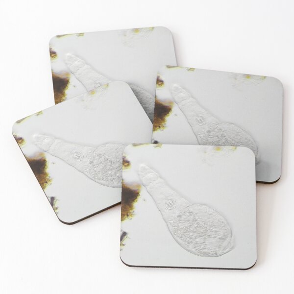 Item preview, Bdelloid rotifer under the microscope designed and sold by SDym Photography.