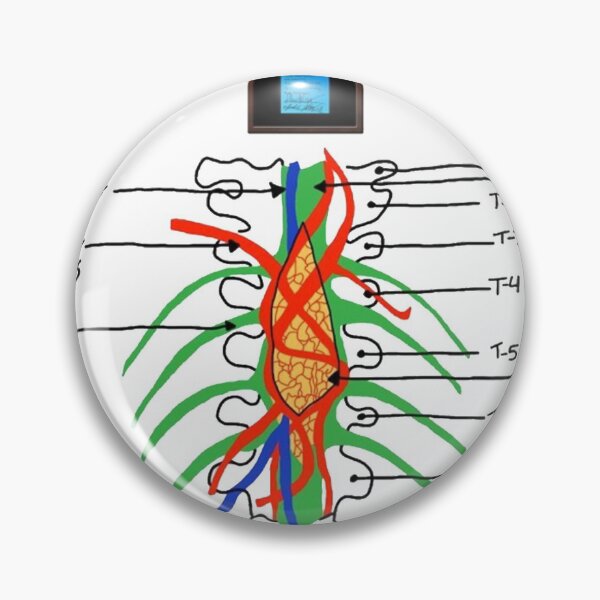 Item preview, Tumor on the wall and post it  designed and sold by AMELA315.