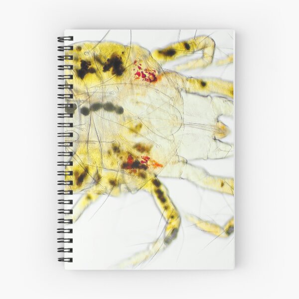 Item preview, Spider mite under the microscope designed and sold by SDym Photography.