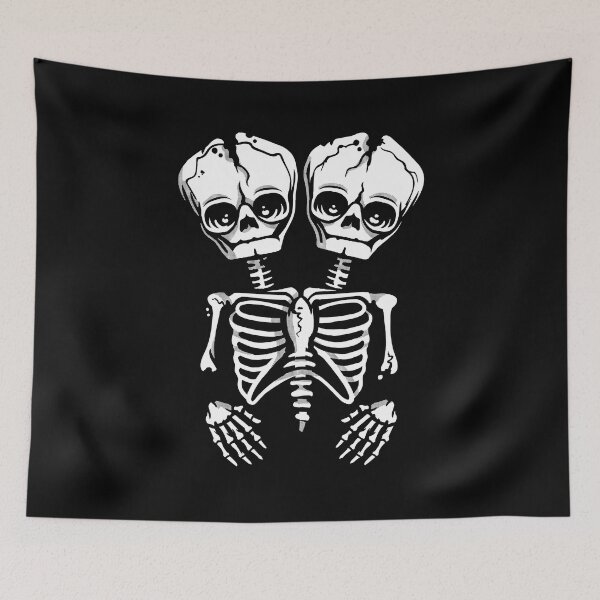 Item preview, Conjoined Skeletons designed and sold by bruceperdew.
