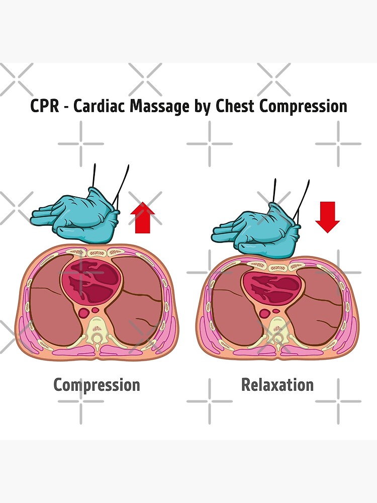 First Aid Resuscitation (CPR), chest compression chest massage for