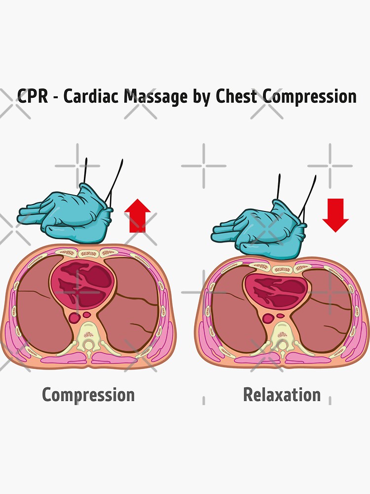 LUCAS Chest Compression – Heart Massage  Dr. Efe's Medical Art Store:  Medical Illustrations and Surgical Art
