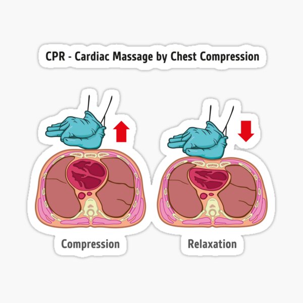 First Aid Resuscitation (CPR), chest compression chest massage for