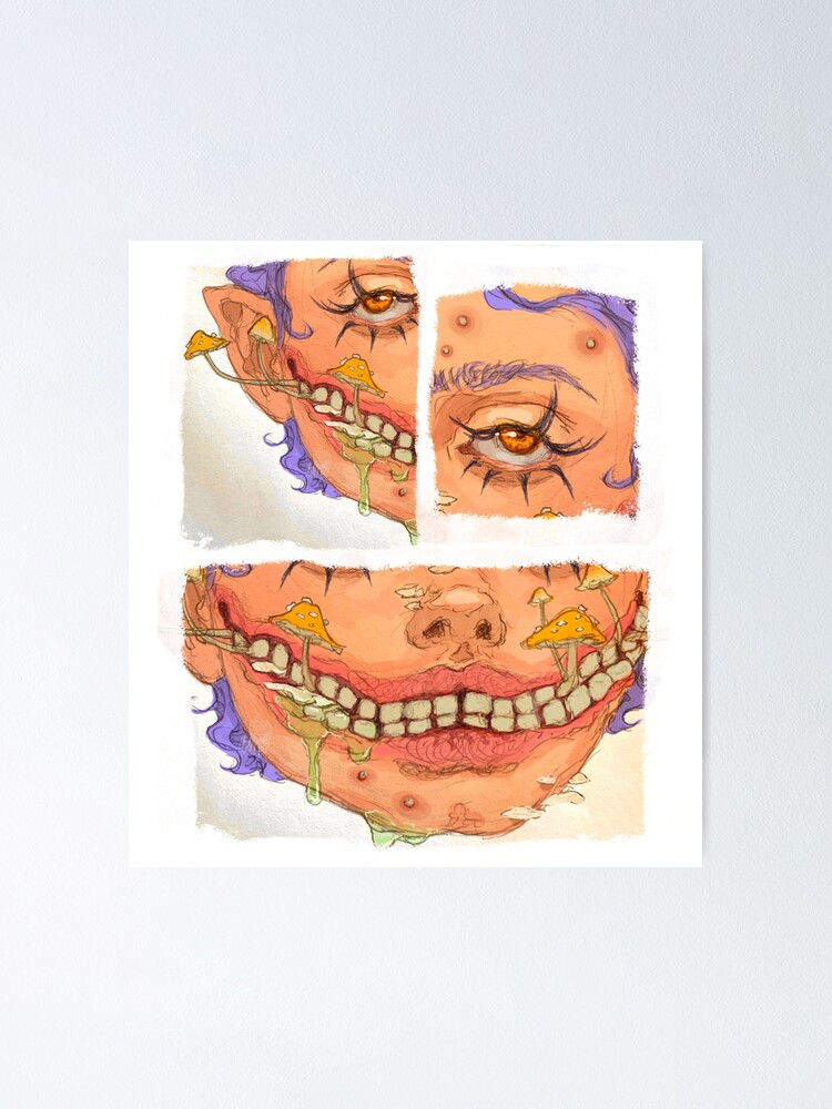 “Gum disease” Poster for Sale by honinip | Redbubble