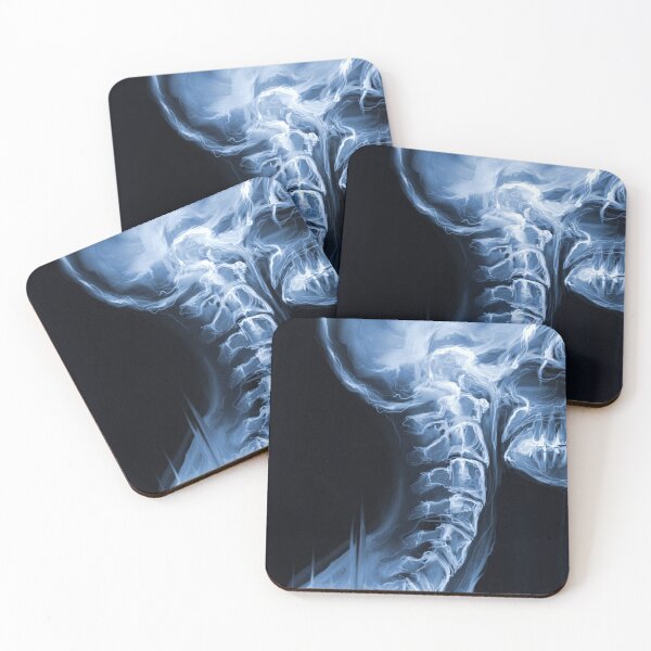 Item preview, X-Ray of Spine & Skull designed and sold by whim-n-wonder.