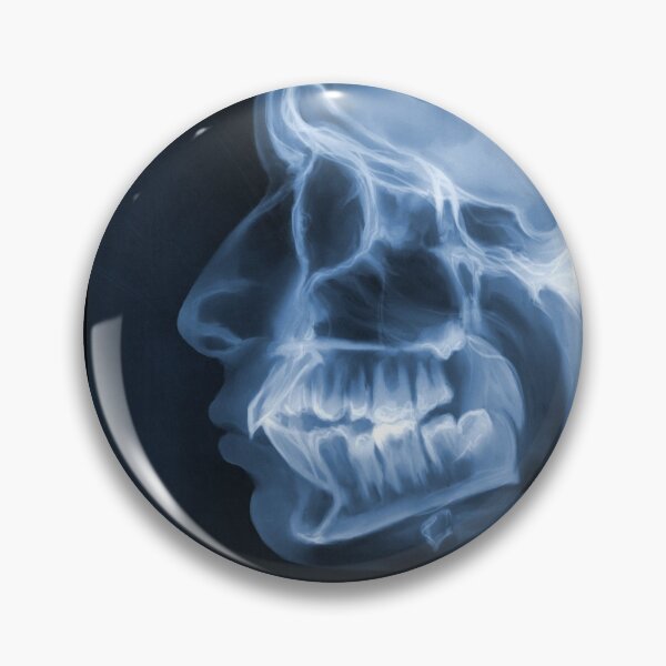 Item preview, X-Ray of Skull in Profile designed and sold by whim-n-wonder.