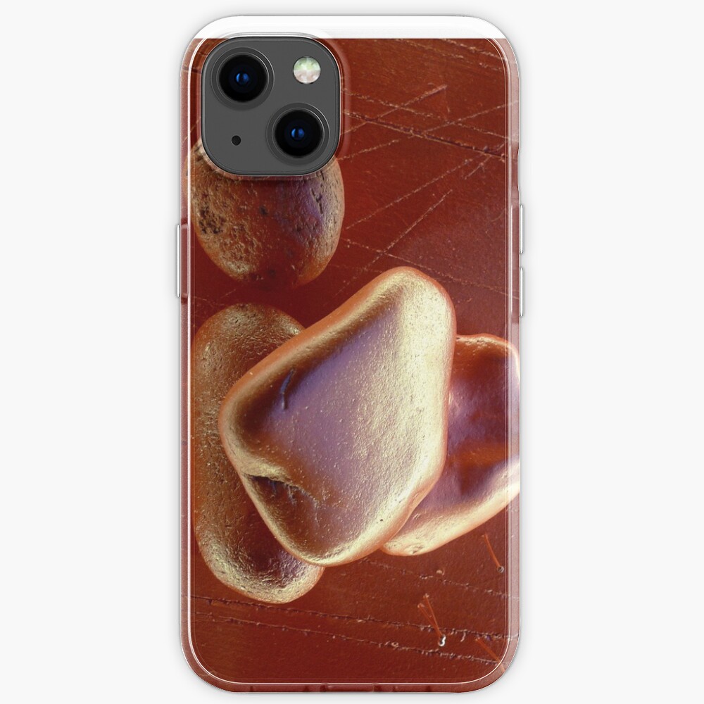 Stones iPhone Case
