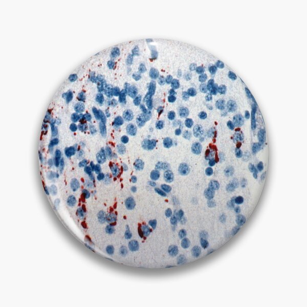 Item preview, Menangle Virus Histology designed and sold by deltoid.