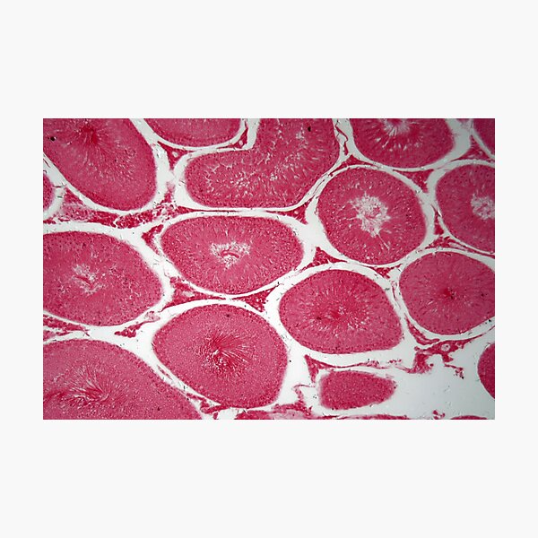 "Microscope photo of a section through cells of rabbit testicles ...