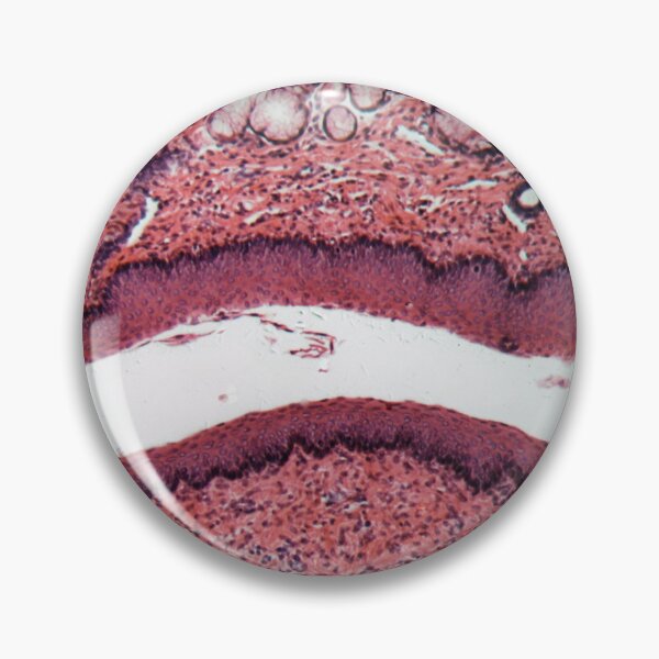 Item preview, Microscope photo of a section through esophagus cells of a dog. designed and sold by Zosimus.