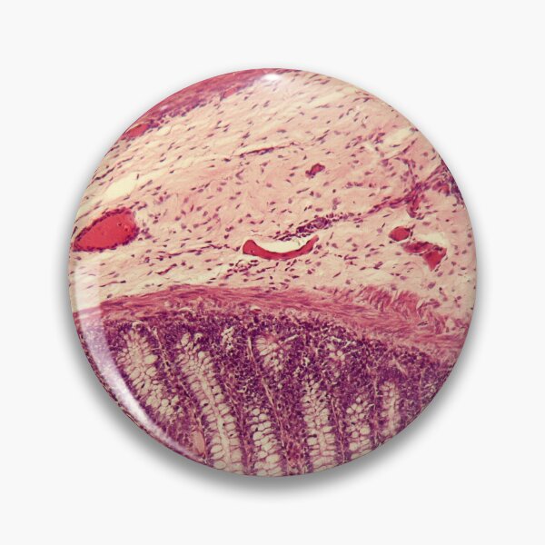 Item preview, Microscope photo of a section through rectum cells of a dog. designed and sold by Zosimus.