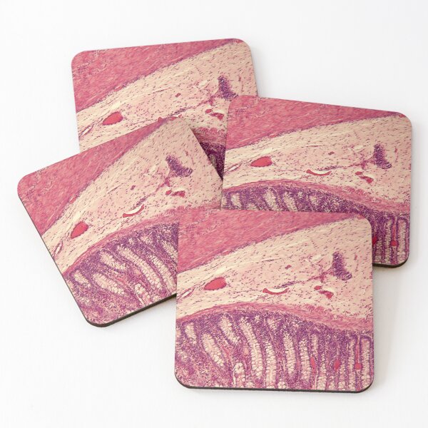 Item preview, Microscope photo of a section through rectum cells of a dog. designed and sold by Zosimus.