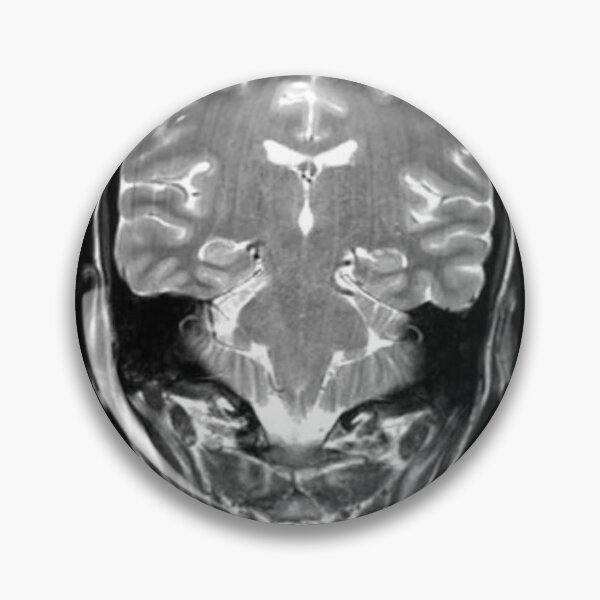 Item preview, Cat on the brain designed and sold by DeltaNorington.
