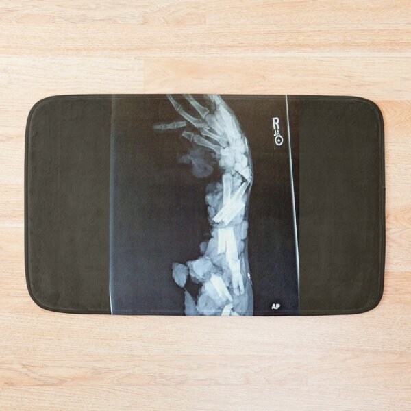 Item preview, broken bone designed and sold by MGRP.
