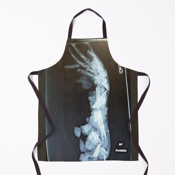 Item preview, broken bone designed and sold by MGRP.
