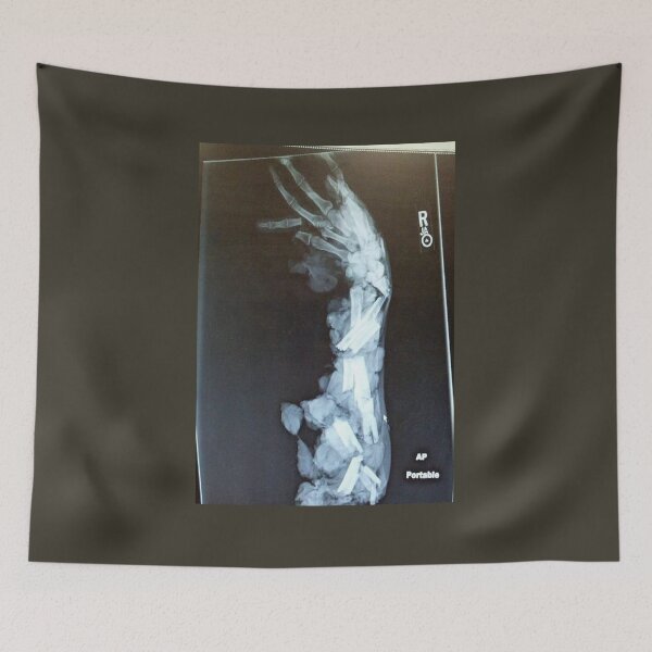 Item preview, broken bone designed and sold by MGRP.