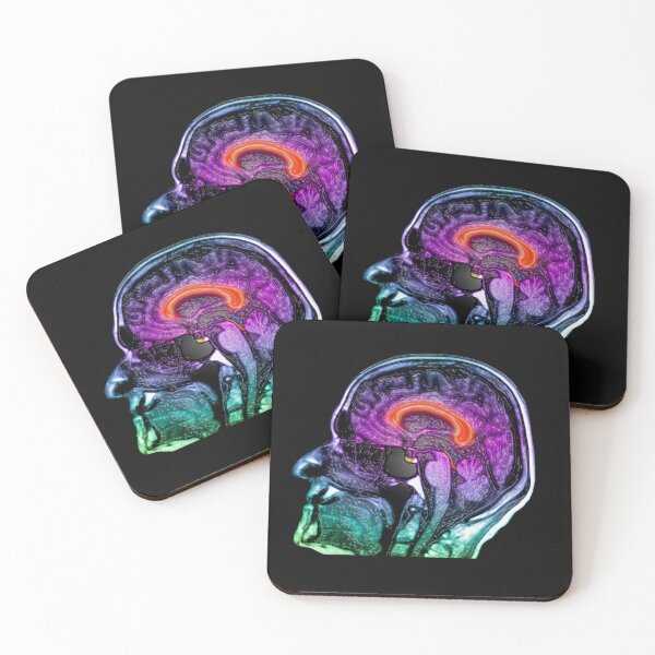 Item preview, Brightly Colored Head and Brain Anatomy MRI Brain Scan designed and sold by ScienceSource.