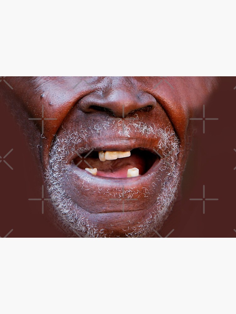 homme noir avec de mauvaises dents