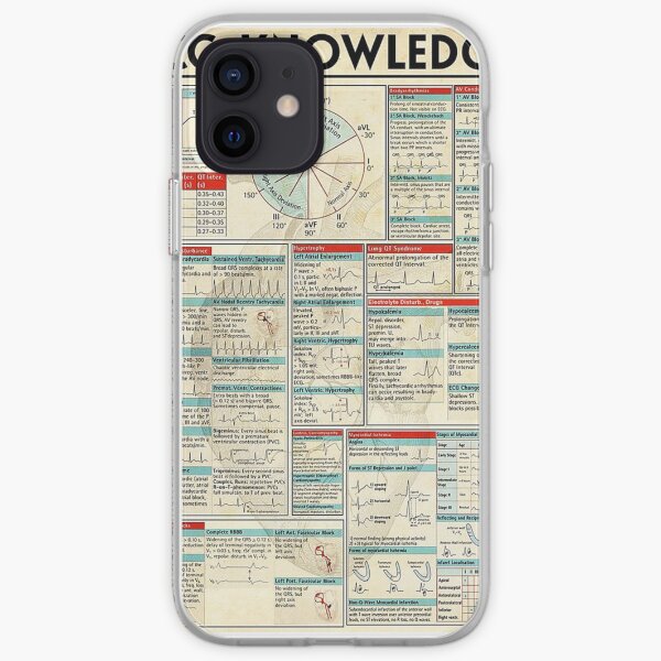 Infographie des connaissances ECG Coque souple iPhone