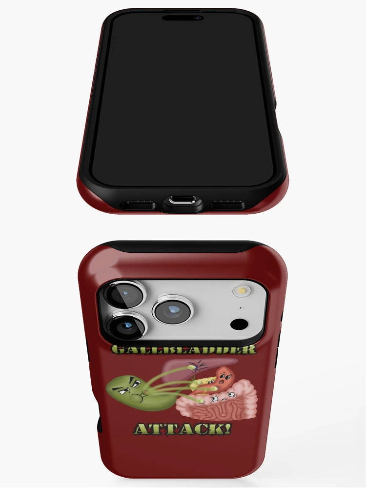 Thumbnail 3 of 4, iPhone Case, Gallbladder Attack designed and sold by RISEHIGHER.