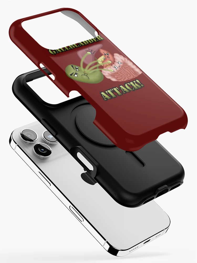 Thumbnail 2 of 4, iPhone Case, Gallbladder Attack designed and sold by RISEHIGHER.