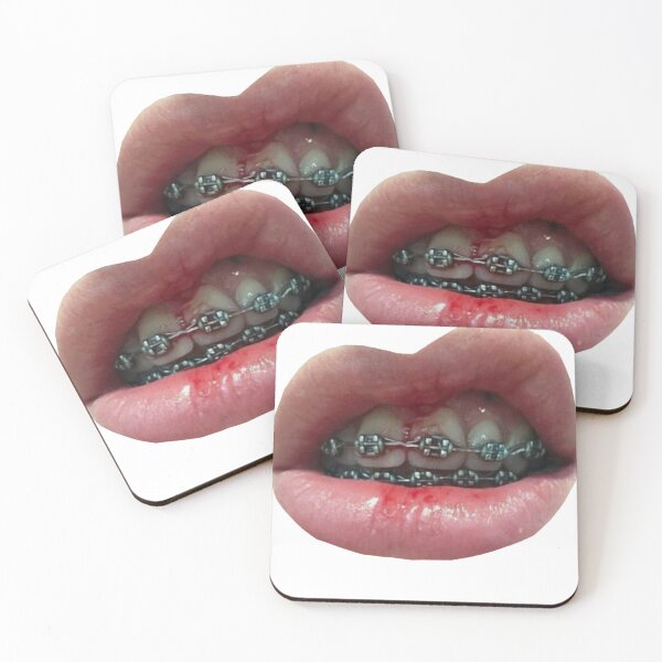 Item preview, bracesf lips designed and sold by WEShop23.