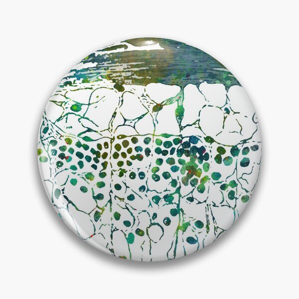 Item preview, Section of Lymphatic Gland designed and sold by EvasDreams.
