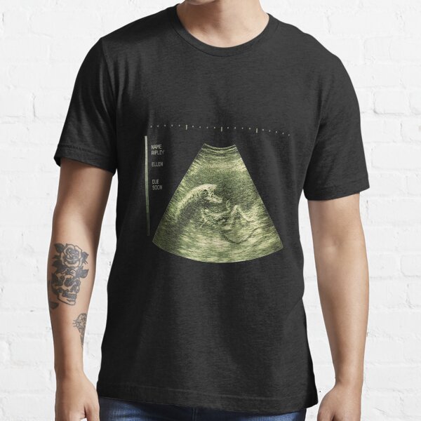 Congratulations, it's a Xenomorph! Essential T-Shirt