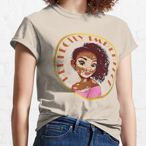 Perfectly imperfect. Vitiligo beauty and support illustration. Classic T-Shirt