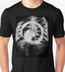 Alien Chest Burster X-Ray Unisex T-Shirt