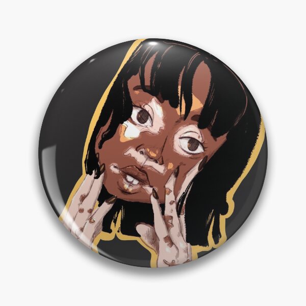Item preview, Girl with vitiligo designed and sold by mccharmley.