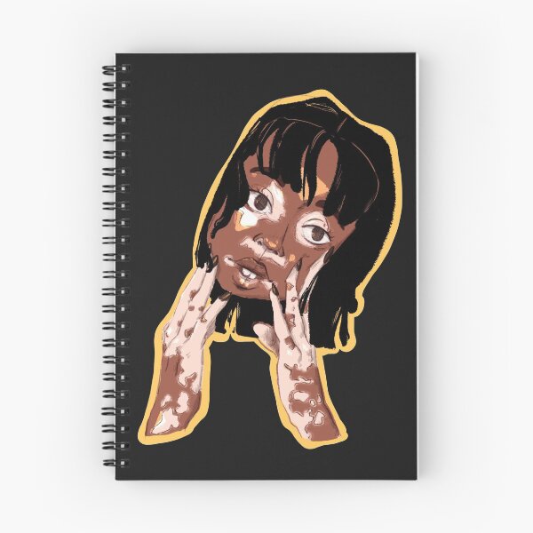 Item preview, Girl with vitiligo designed and sold by mccharmley.