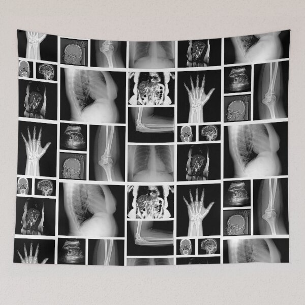 Item preview, Trapped in my Body - X-Ray Hand  designed and sold by aimeewilson.