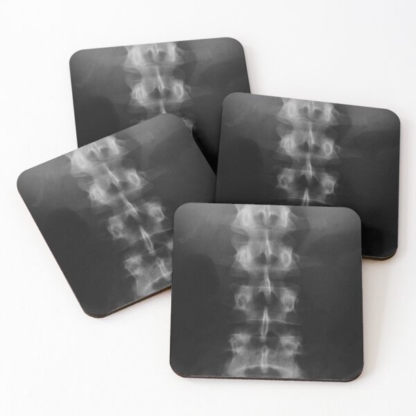 Item preview, X-ray printmaking x-ray photography designed and sold by MKartss.