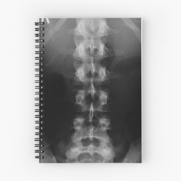 Item preview, X-ray printmaking x-ray photography designed and sold by MKartss.