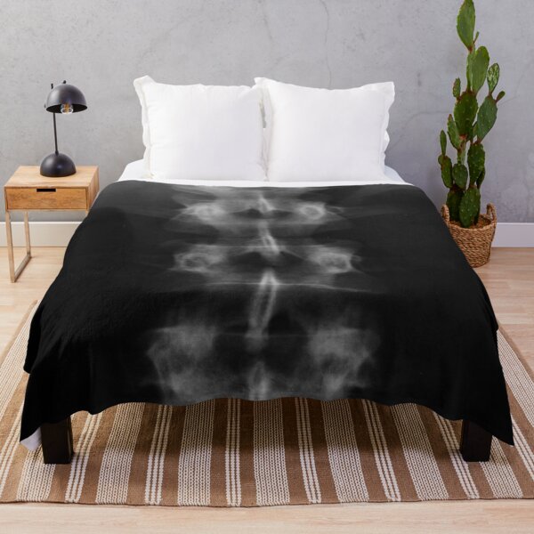 Item preview, X-ray printmaking x-ray photography designed and sold by MKartss.