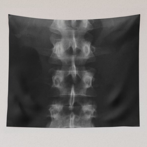 Item preview, X-ray printmaking x-ray photography designed and sold by MKartss.