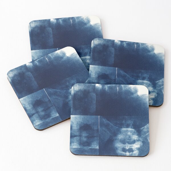 Item preview, Cyanotype Art Prints Graphic Art - X-rays Skeleton designed and sold by MKartss.