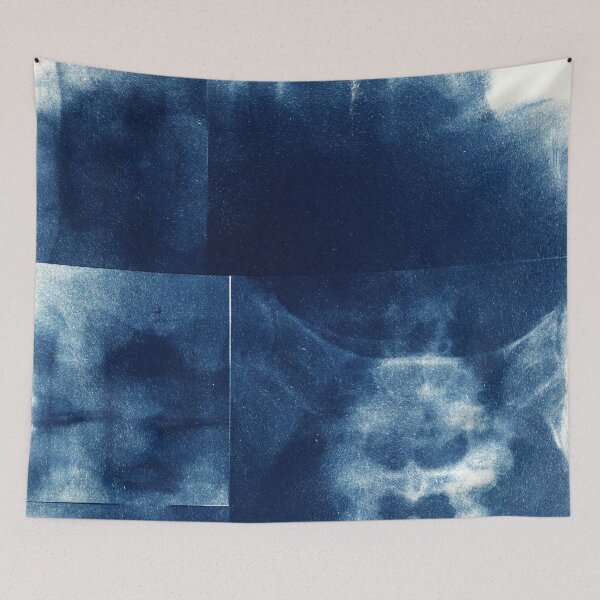 Item preview, Cyanotype Art Prints Graphic Art - X-rays Skeleton designed and sold by MKartss.