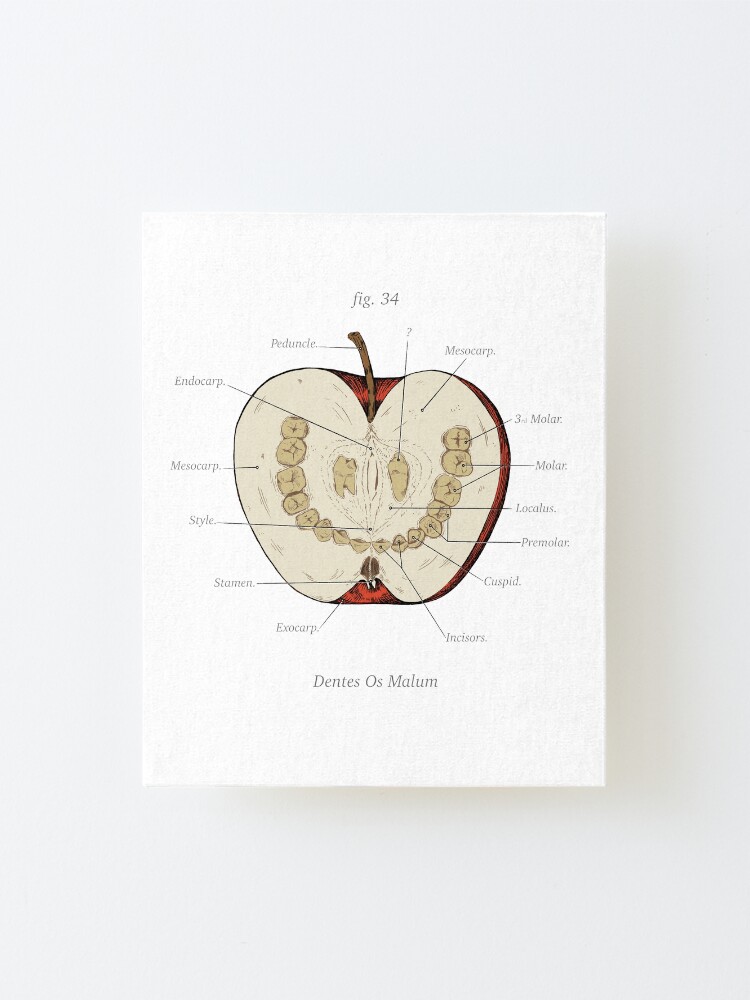 Alternate view of The Magnus Archives - Anatomy Class - Teeth Apple Mounted Print