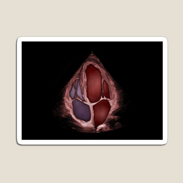 Item preview, Cámara 3D Apical 4 con efecto sangre designed and sold by EchoArtUK.