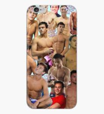 Tom Daley Collage iPhone Case