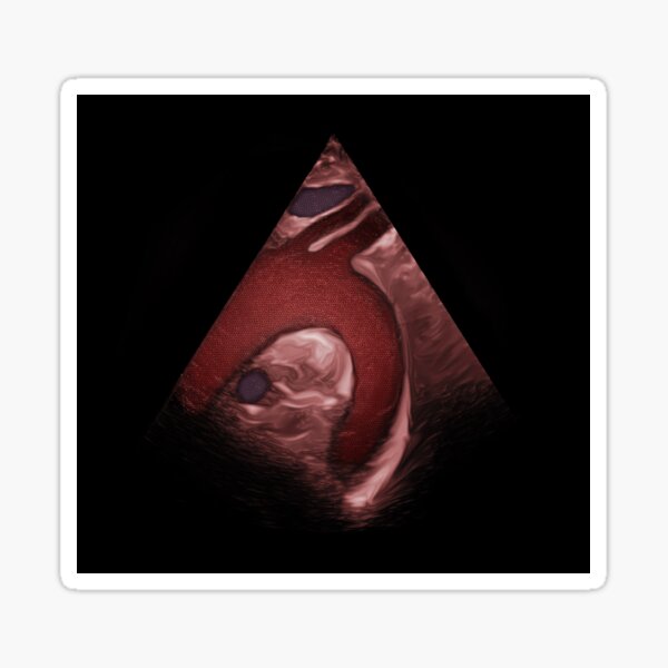 Item preview, 3D Aortic Arch  designed and sold by EchoArtUK.