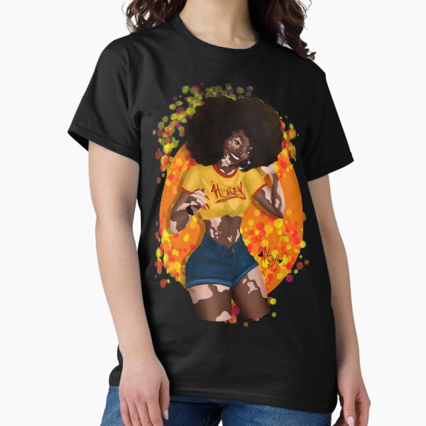 Item preview, Vitiligo Vixen designed and sold by Martina Adams.