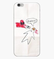 Ouchie! iPhone Case