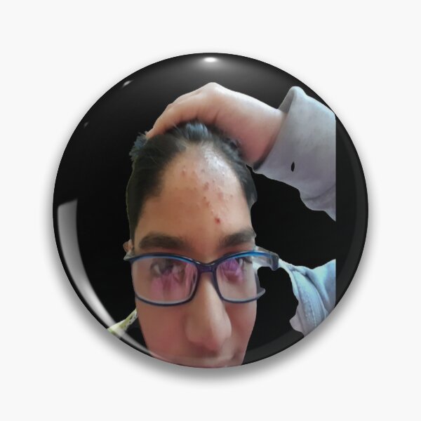 Item preview, Real pimple  designed and sold by Hamaridukaan.